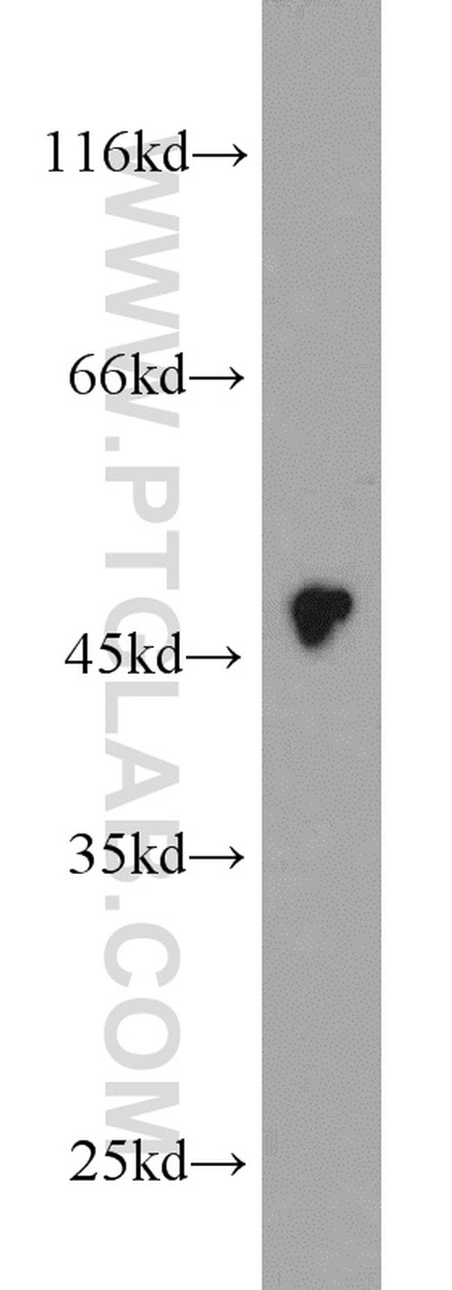 CX3CR1 Antibody in Western Blot (WB)