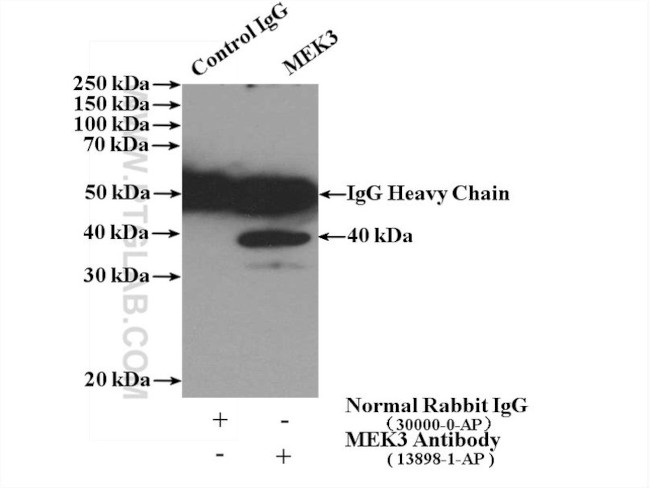 MEK3 Antibody in Immunoprecipitation (IP)