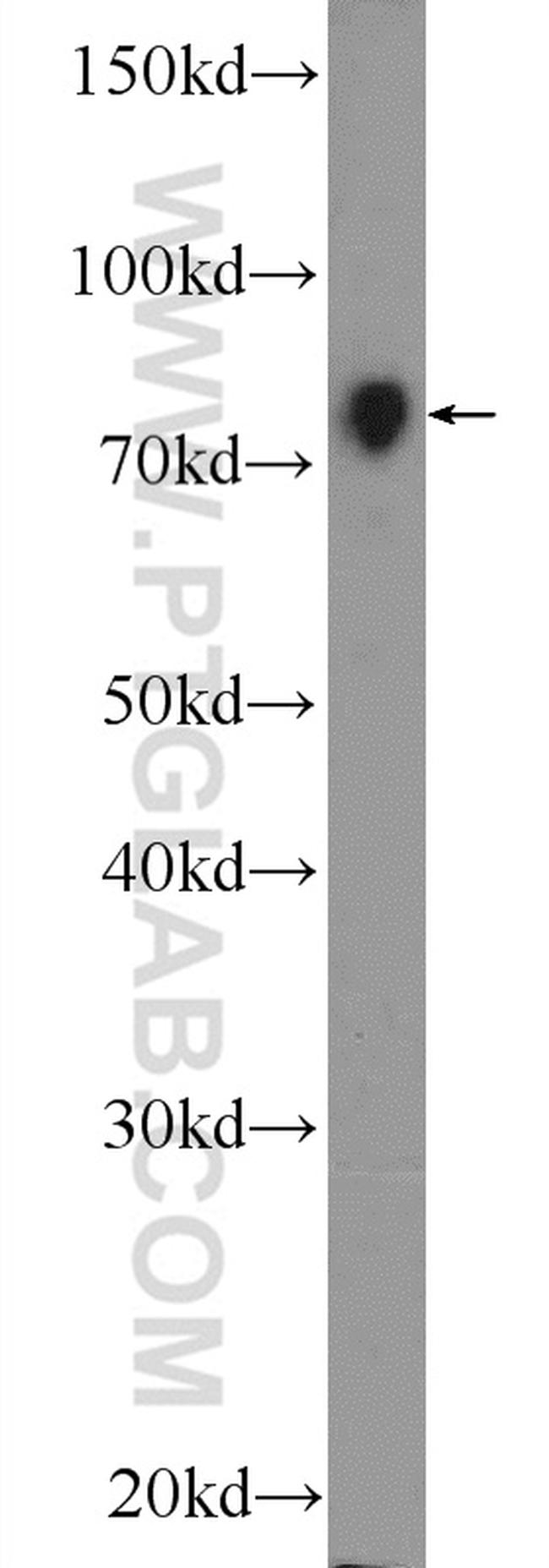 NR1D2 Antibody in Western Blot (WB)