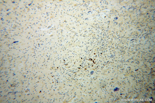 KIF3A Antibody in Immunohistochemistry (Paraffin) (IHC (P))