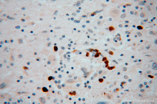 KIF3A Antibody in Immunohistochemistry (Paraffin) (IHC (P))