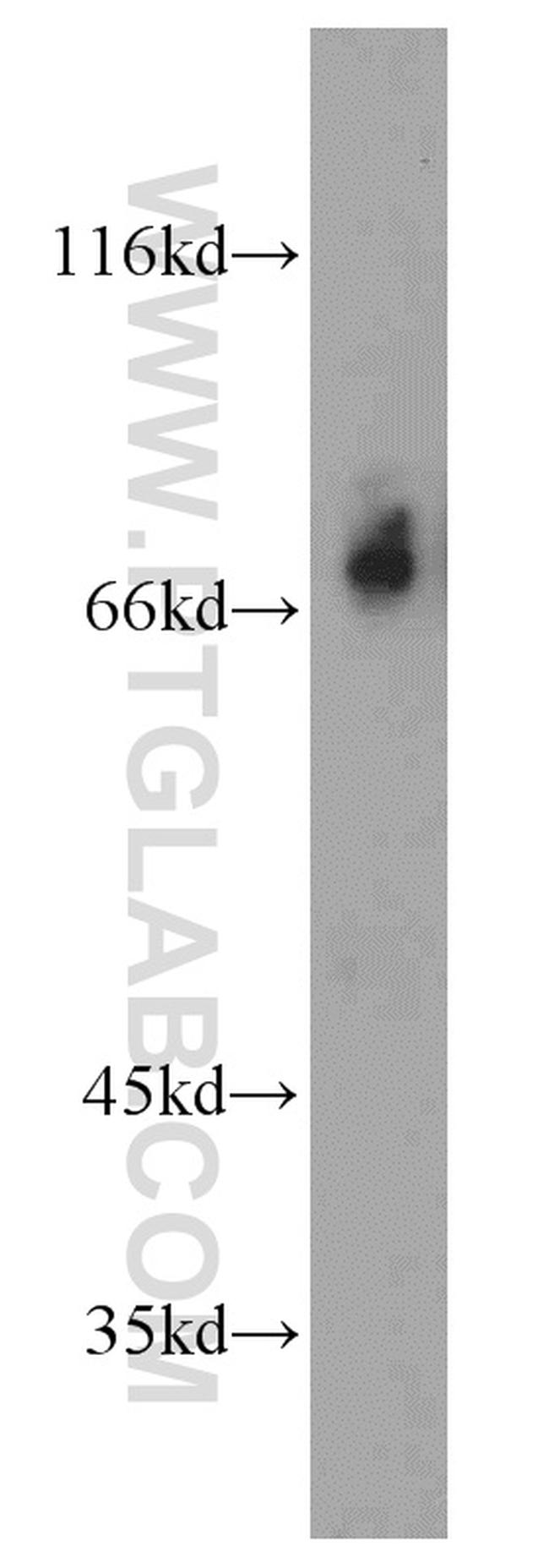 KIF3A Antibody in Western Blot (WB)