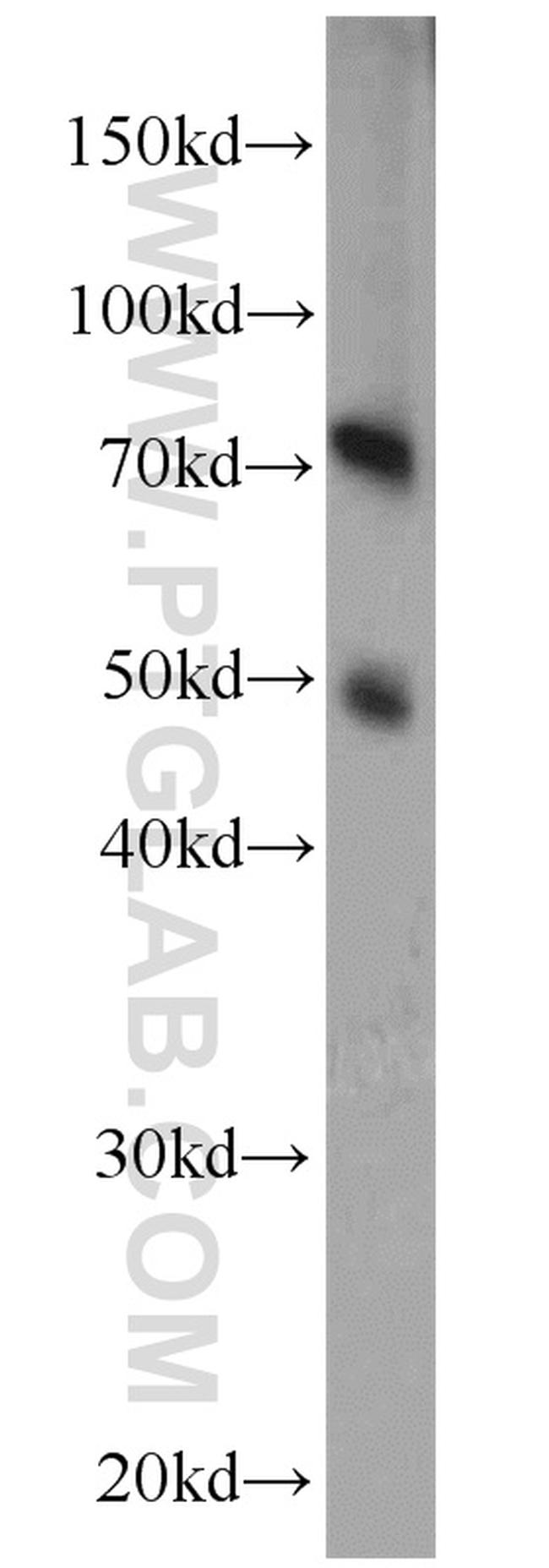 ADAM2 Antibody in Western Blot (WB)