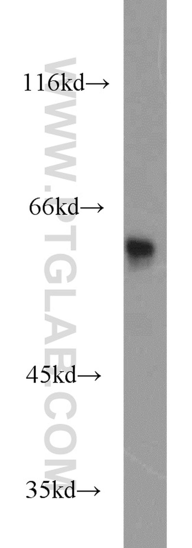 KPNA5 Antibody in Western Blot (WB)
