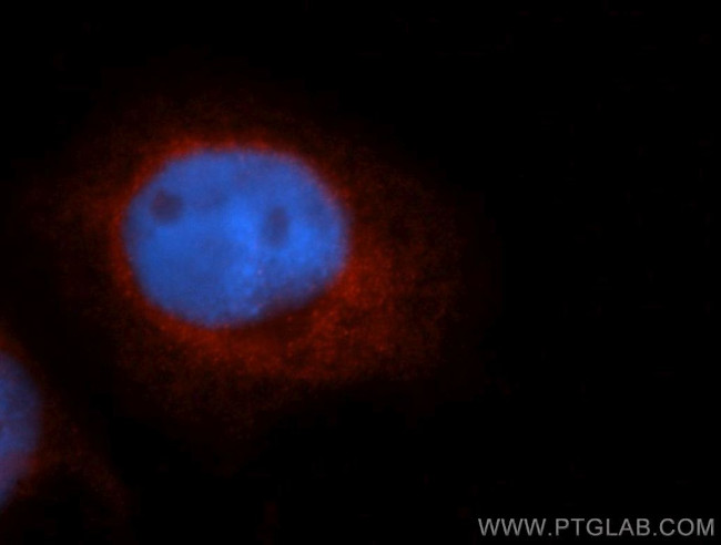 ZnT7 Antibody in Immunocytochemistry (ICC/IF)