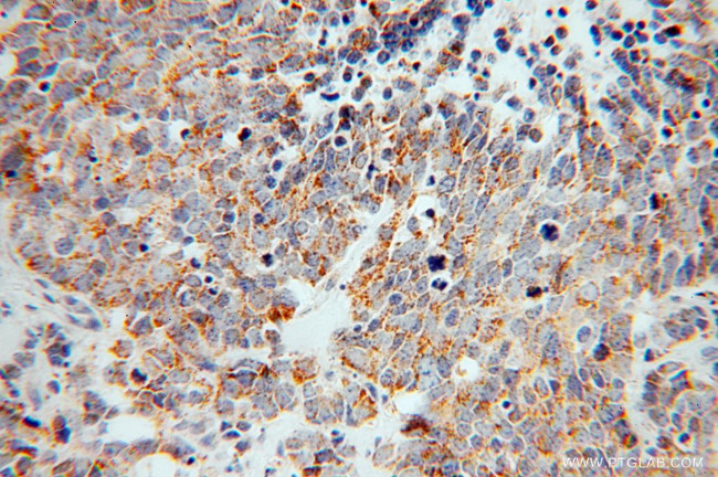 ZnT7 Antibody in Immunohistochemistry (Paraffin) (IHC (P))