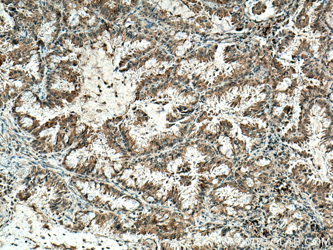 ZnT7 Antibody in Immunohistochemistry (Paraffin) (IHC (P))