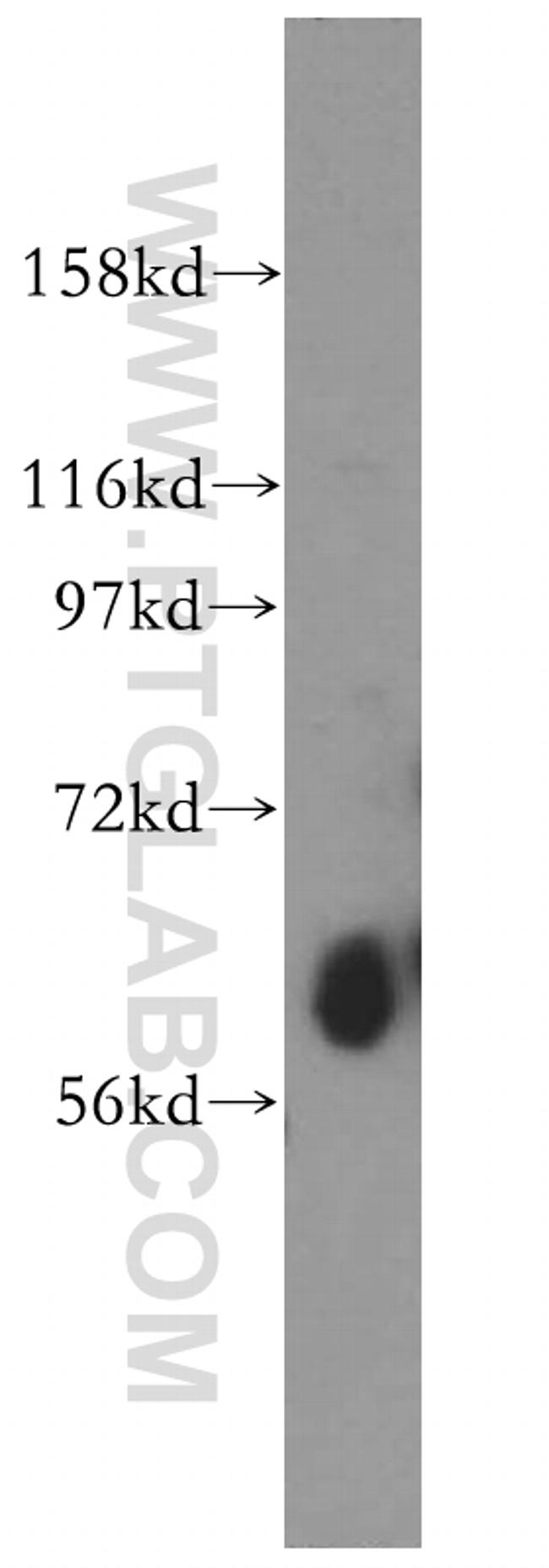 ZnT7 Antibody in Western Blot (WB)