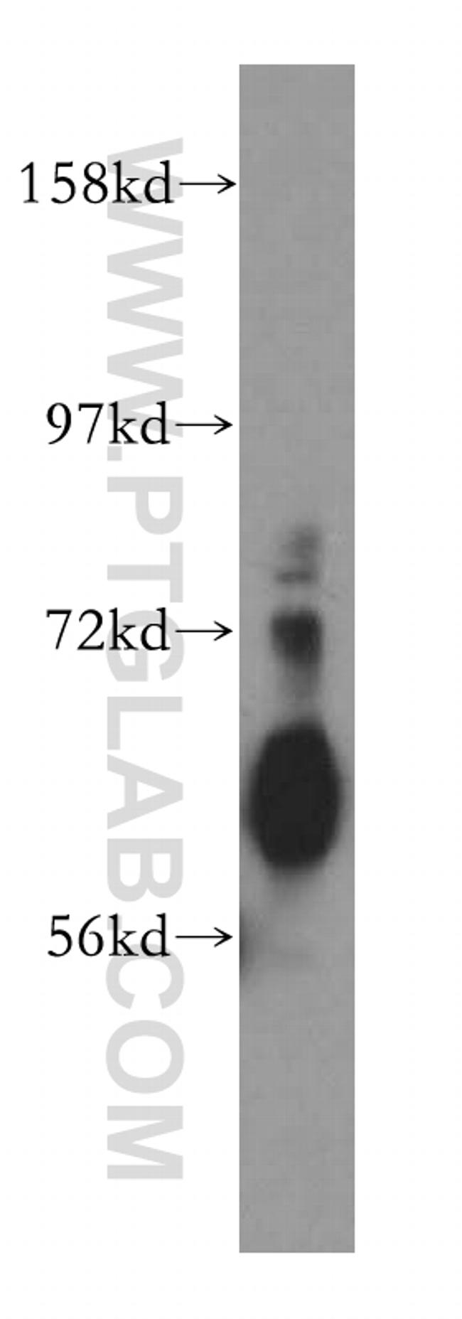 ZnT7 Antibody in Western Blot (WB)