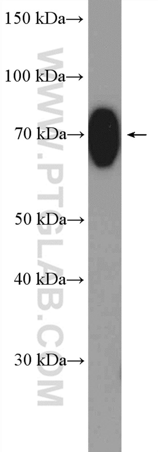 HSPA1L Antibody in Western Blot (WB)