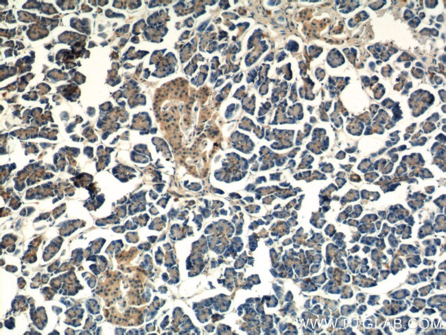 ALS2 Antibody in Immunohistochemistry (Paraffin) (IHC (P))