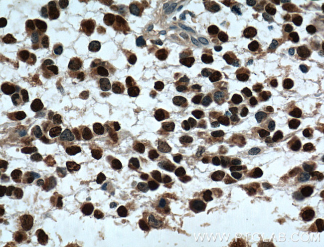 OLIG2 Antibody in Immunohistochemistry (Paraffin) (IHC (P))