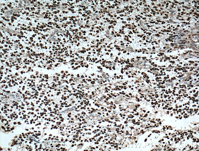 OLIG2 Antibody in Immunohistochemistry (Paraffin) (IHC (P))