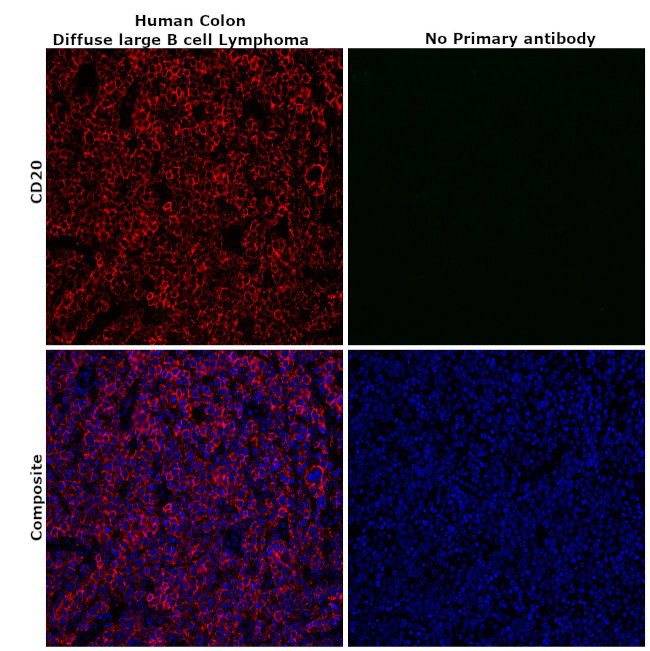 CD20 Antibody in Immunohistochemistry (Paraffin) (IHC (P))