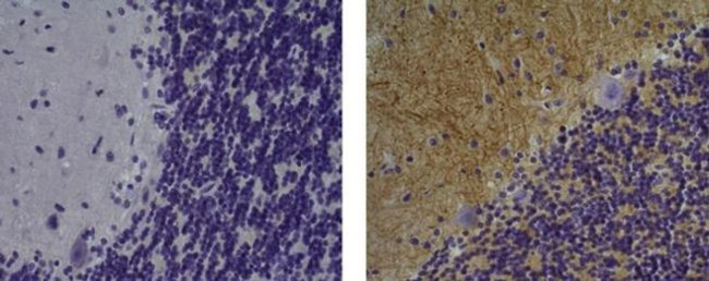 CD56 (NCAM) Antibody in Immunohistochemistry (Paraffin) (IHC (P))