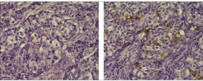 CD66e (CEA) Antibody in Immunohistochemistry (Paraffin) (IHC (P))