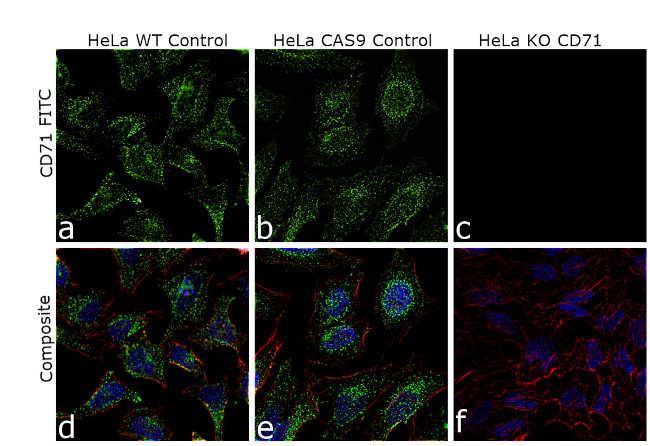 CD71 (Transferrin Receptor) Antibody in Immunocytochemistry (ICC/IF)