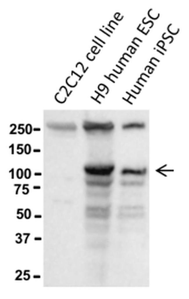 P-Cadherin Antibody in Western Blot (WB)