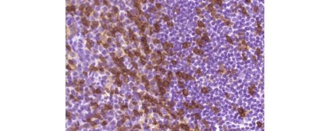 CD4 Antibody in Immunohistochemistry (Paraffin) (IHC (P))