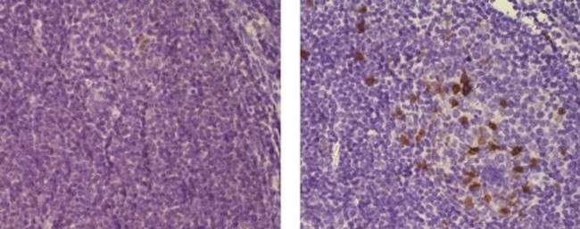 Mouse IgM Isotype Control in Immunohistochemistry (Paraffin) (IHC (P))