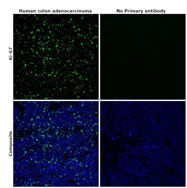 Ki-67 Antibody in Immunohistochemistry (Paraffin) (IHC (P))