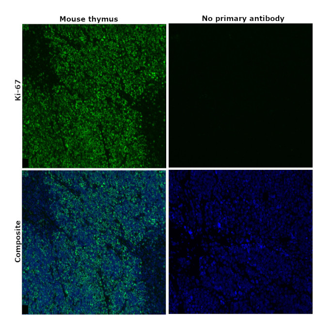 Ki-67 Antibody in Immunohistochemistry (Paraffin) (IHC (P))