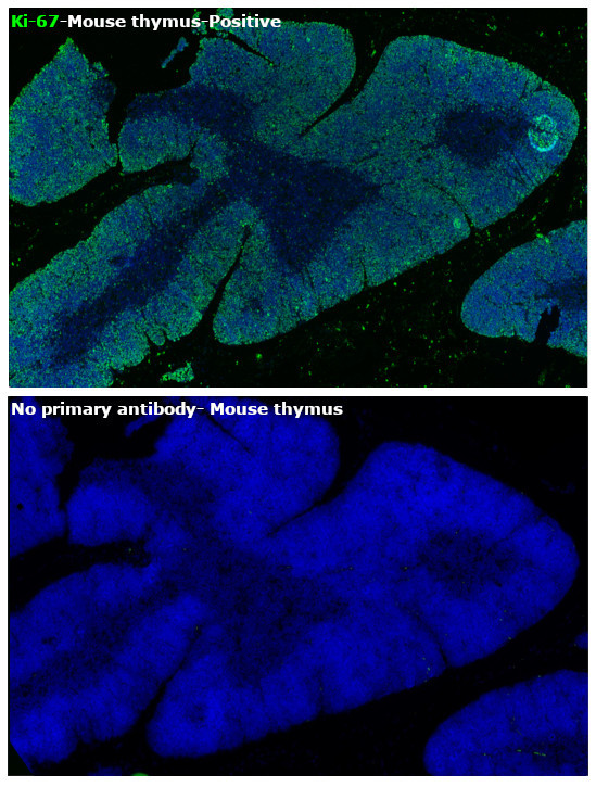 Ki-67 Antibody in Immunohistochemistry (Paraffin) (IHC (P))