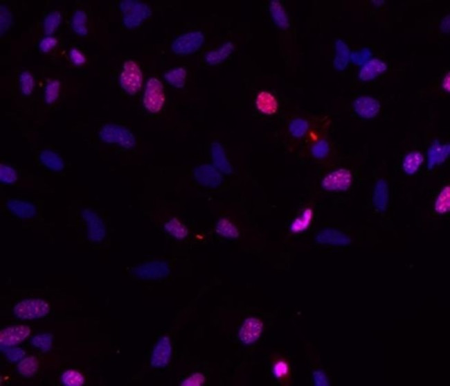 Survivin Antibody in Immunocytochemistry (ICC/IF)