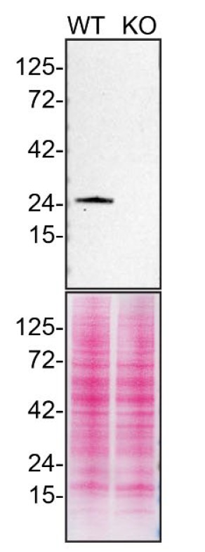 RAB5A Monoclonal Antibody (2E8B11) (14-9711-82)