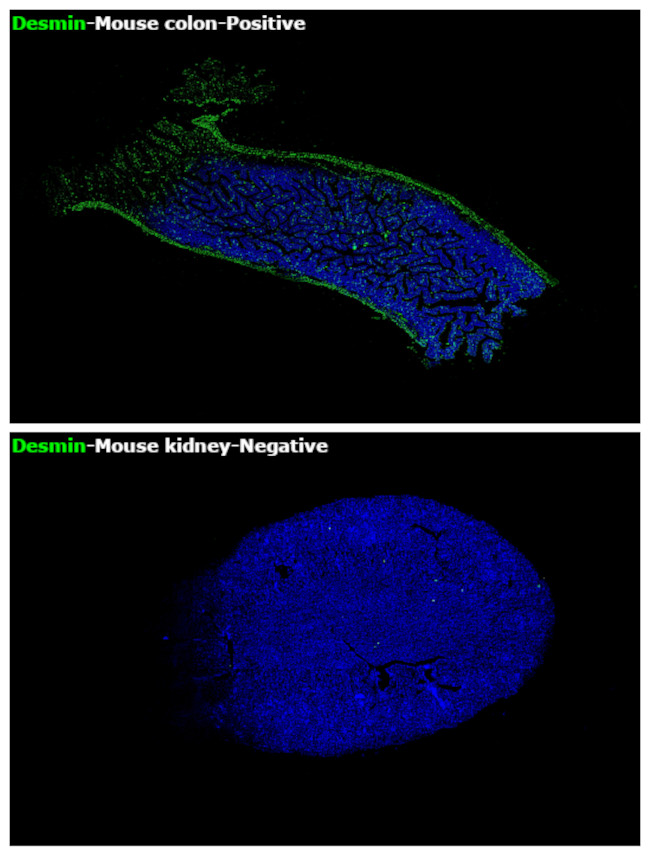 Desmin Antibody