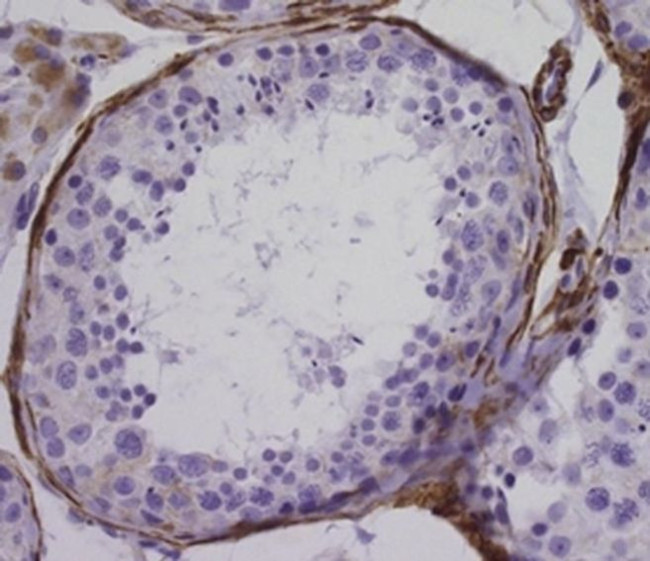 Desmin Antibody in Immunohistochemistry (Paraffin) (IHC (P))