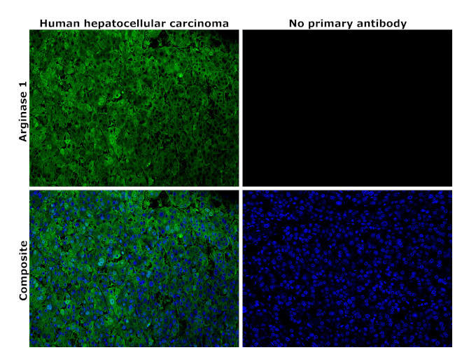 Arginase 1 Antibody in Immunohistochemistry (Paraffin) (IHC (P))