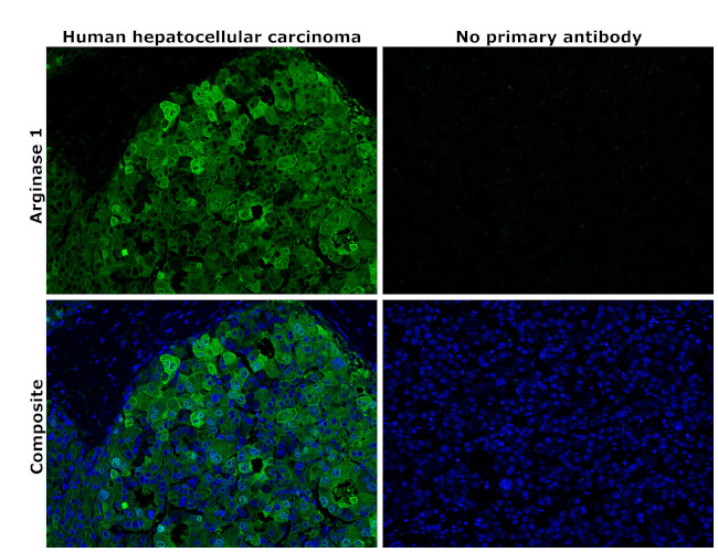 Arginase 1 Antibody in Immunohistochemistry (Paraffin) (IHC (P))