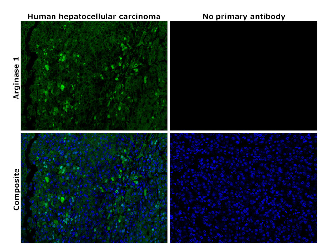 Arginase 1 Antibody in Immunohistochemistry (Paraffin) (IHC (P))