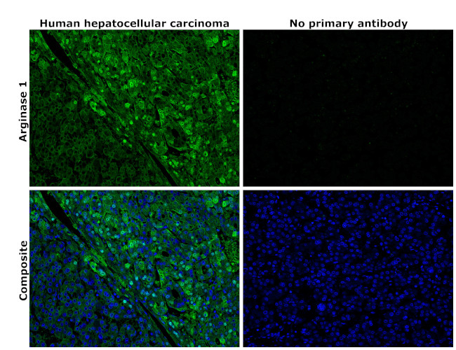 Arginase 1 Antibody in Immunohistochemistry (Paraffin) (IHC (P))