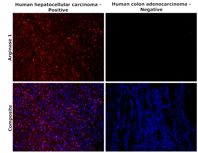 Arginase 1 Antibody in Immunohistochemistry (Paraffin) (IHC (P))