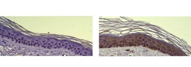 Cytokeratin 6 Antibody in Immunohistochemistry (Paraffin) (IHC (P))