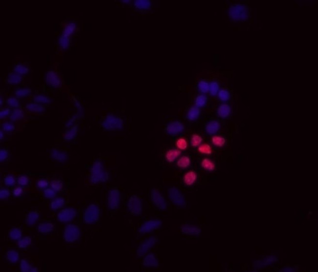 UTF1 Antibody in Immunocytochemistry (ICC/IF)