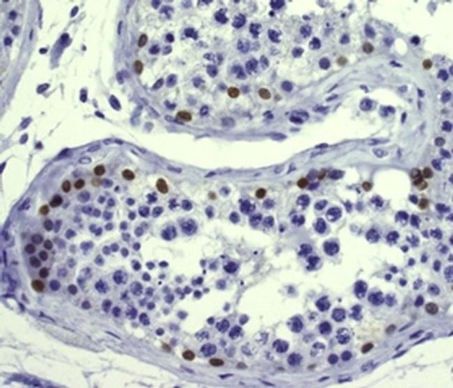 UTF1 Antibody in Immunohistochemistry (Paraffin) (IHC (P))