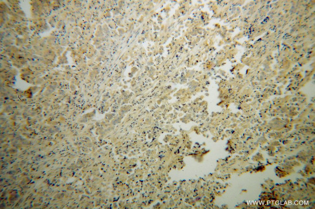 PPP3R2 Antibody in Immunohistochemistry (Paraffin) (IHC (P))