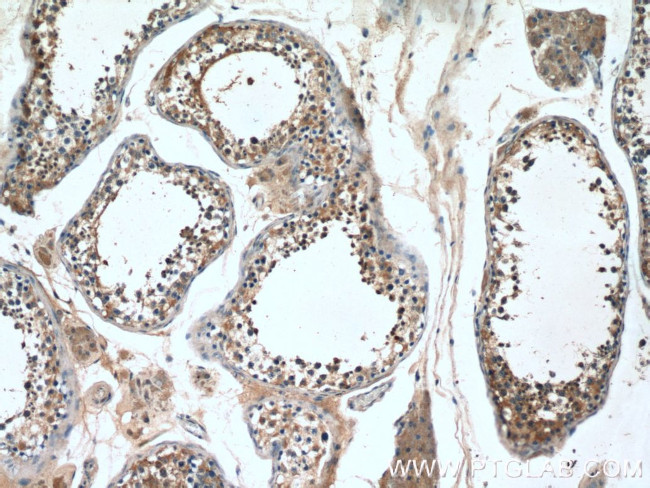 PPP3R2 Antibody in Immunohistochemistry (Paraffin) (IHC (P))