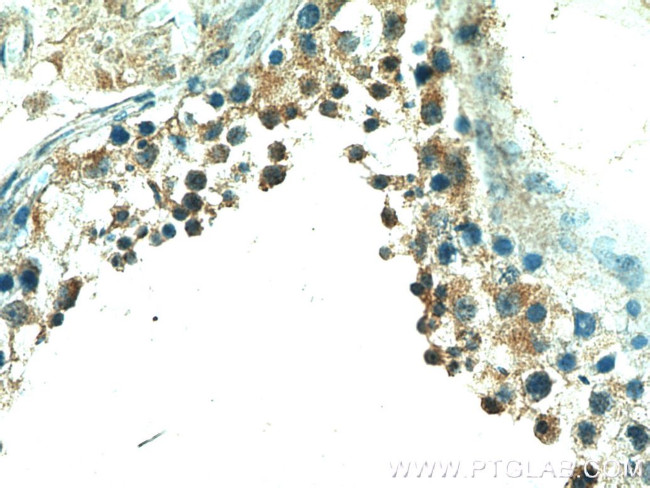 PPP3R2 Antibody in Immunohistochemistry (Paraffin) (IHC (P))