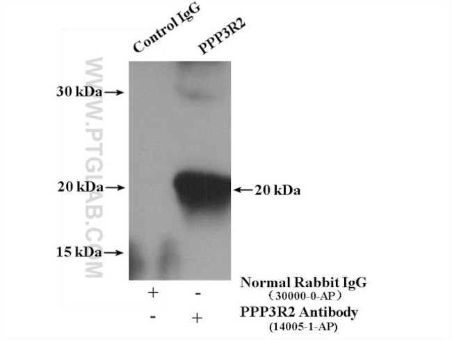 PPP3R2 Antibody in Immunoprecipitation (IP)