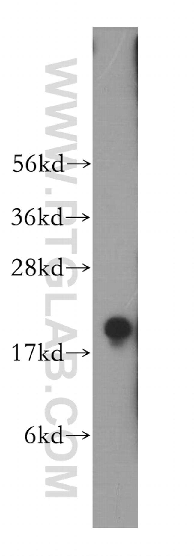 PPP3R2 Antibody in Western Blot (WB)