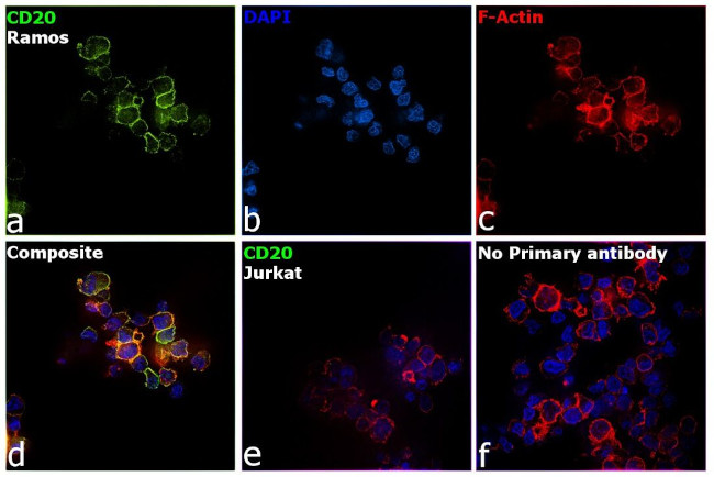 CD20 Antibody