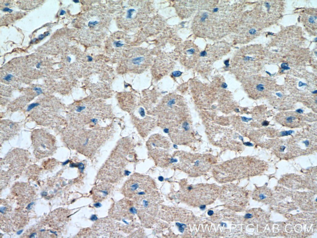 SOCS3 Antibody in Immunohistochemistry (Paraffin) (IHC (P))