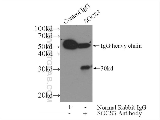 SOCS3 Antibody in Immunoprecipitation (IP)