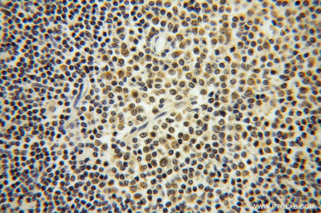 ROD1 Antibody in Immunohistochemistry (Paraffin) (IHC (P))