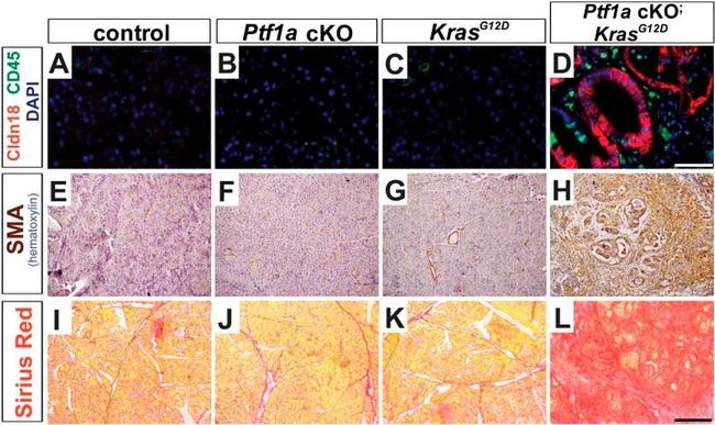 CD45 Antibody in Immunohistochemistry (IHC)