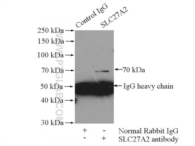 SLC27A2 Antibody in Immunoprecipitation (IP)